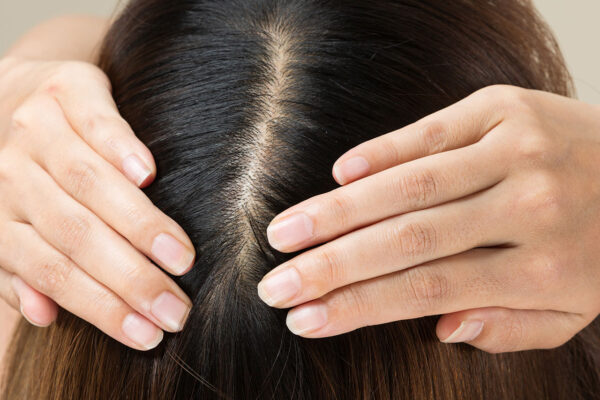 woman showing off her healthy hair scalp 1 5 Expert-Approved Hair Oils And Serums That Can Transform Fine, Weak Hair Into Thicker Locks